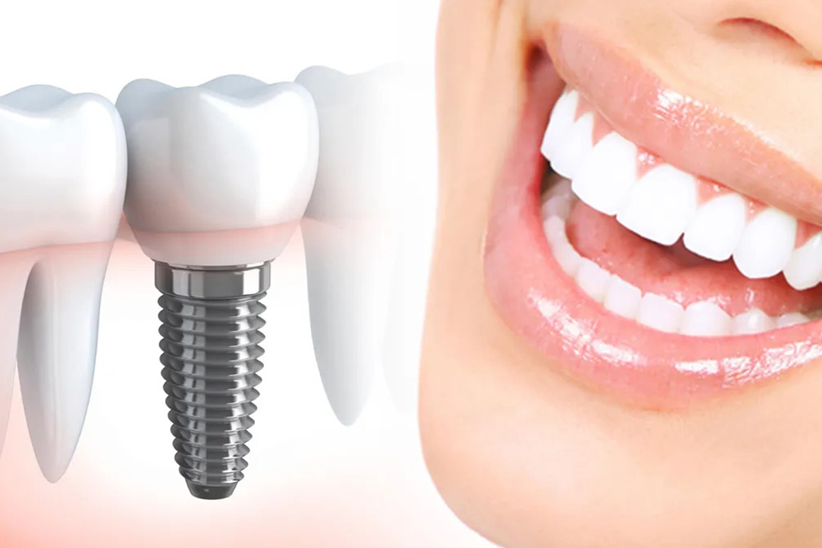 Why Modern Clinics Trust Intake Dental for AI Powered Practice Expansion?